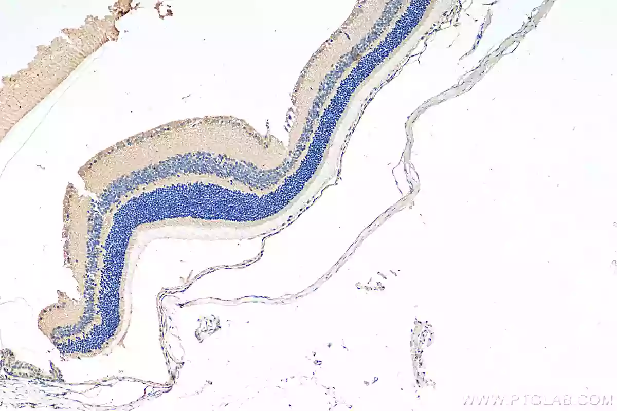 Piezo2 antibody (26205-1-AP) | Proteintech