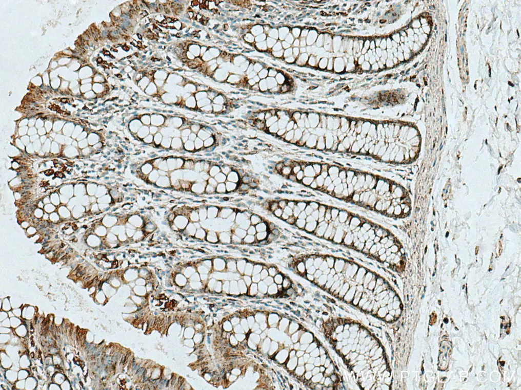 RAB32 antibody (10999-1-AP) | Proteintech