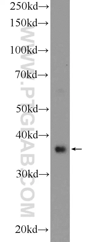 RAD51 antibody 14961 1 AP Proteintech