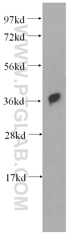 RAD51 antibody 14961 1 AP Proteintech