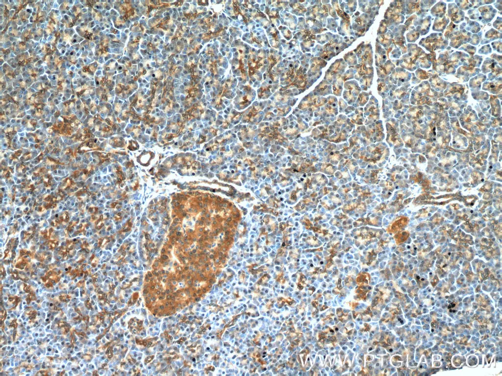 Immunohistochemical analysis of paraffin-embedded human pancreas tissue slide using 17563-1-AP (RIP3 antibody) at dilution of 1:200 (under 10x lens).