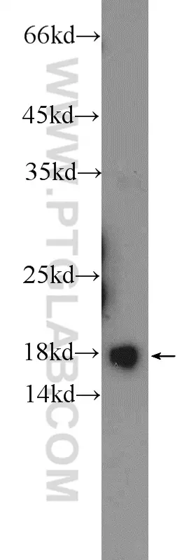 RPS24 antibody (14831-1-AP) | Proteintech