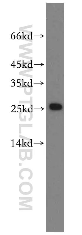 RPS8 antibody (18228-1-AP) | Proteintech