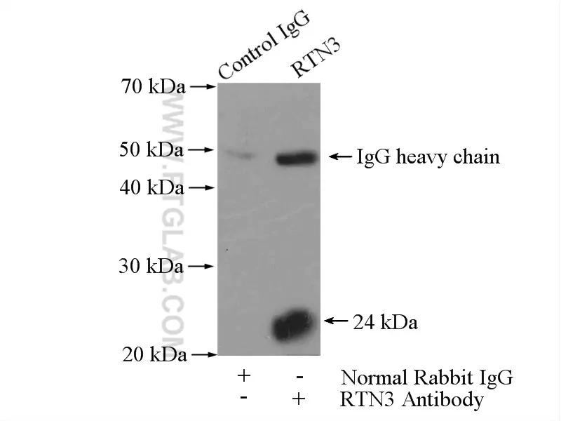 RTN3 antibody (12055-2-AP) | Proteintech