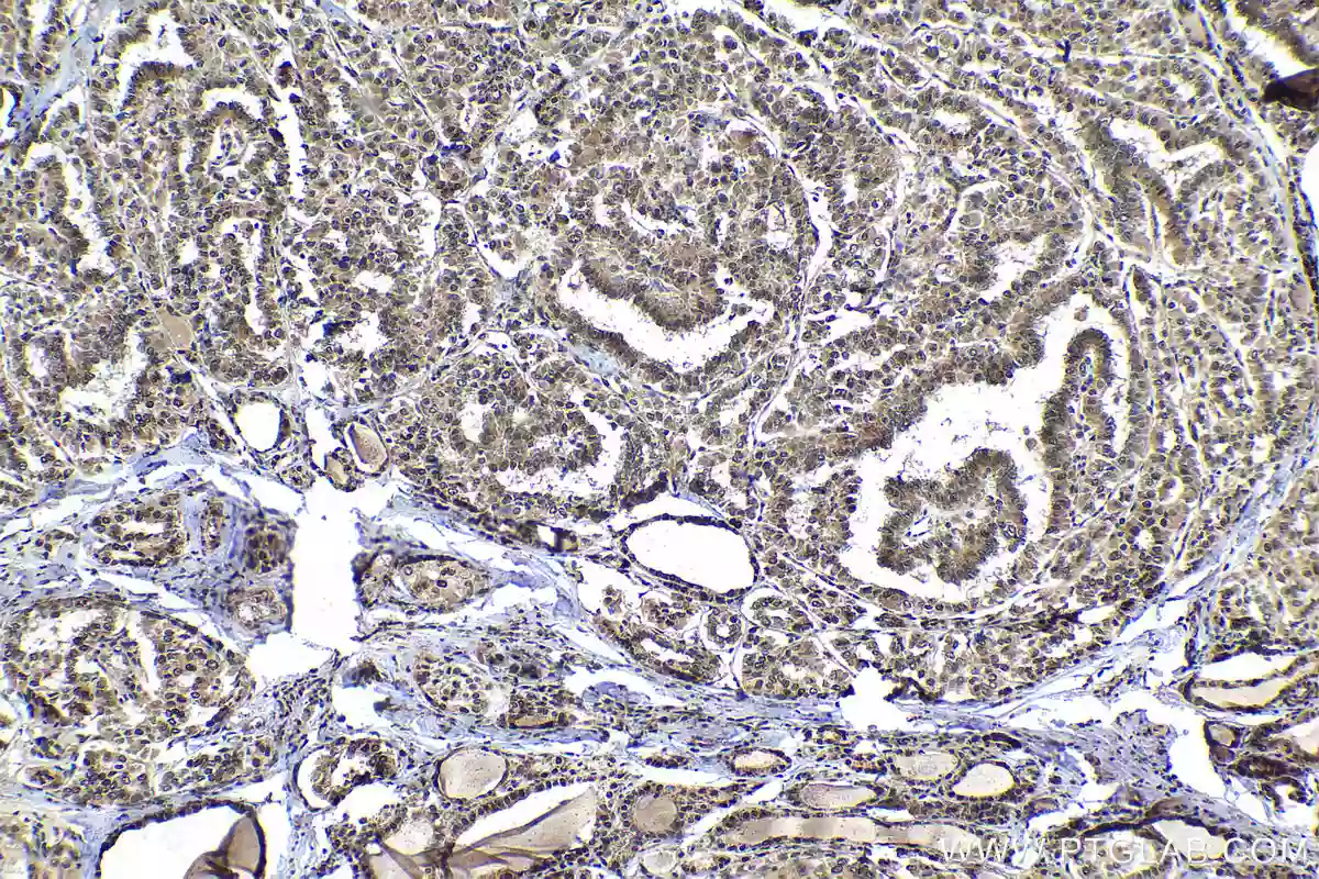 Recombinant Anti-ROR alpha/RORA antibody [EPR23719-18] (ab256799)