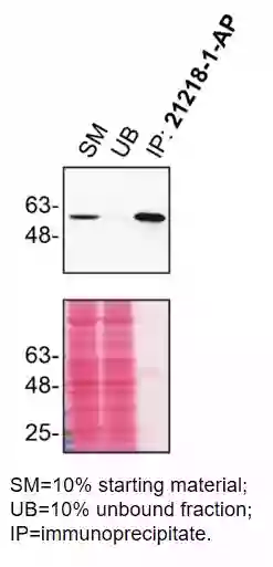 Recombinant Anti-ROR alpha/RORA antibody [EPR23719-18] (ab256799