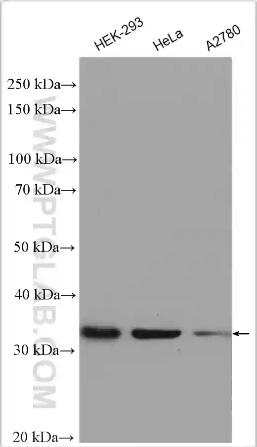 Rad51D antibody 11126 1 AP Proteintech