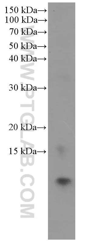 S100A11 antibody (60024-1-Ig) | Proteintech