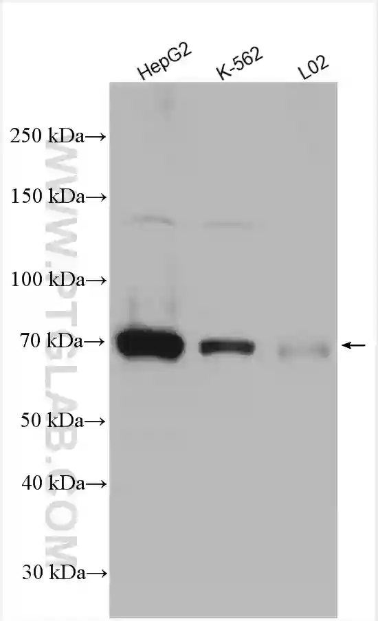 SAMHD1 antibody (12586-1-AP) | Proteintech