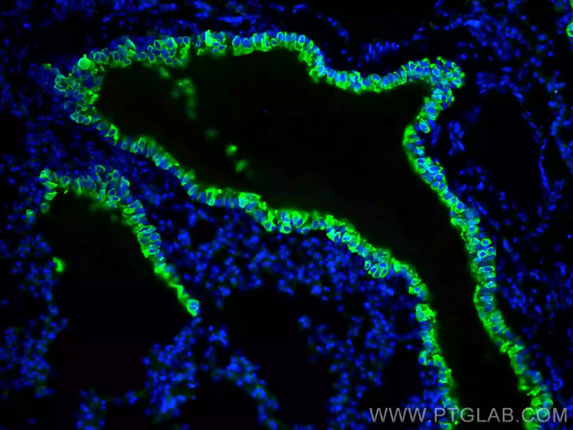 Uteroglobin/CC10 antibody (10490-1-AP) | Proteintech