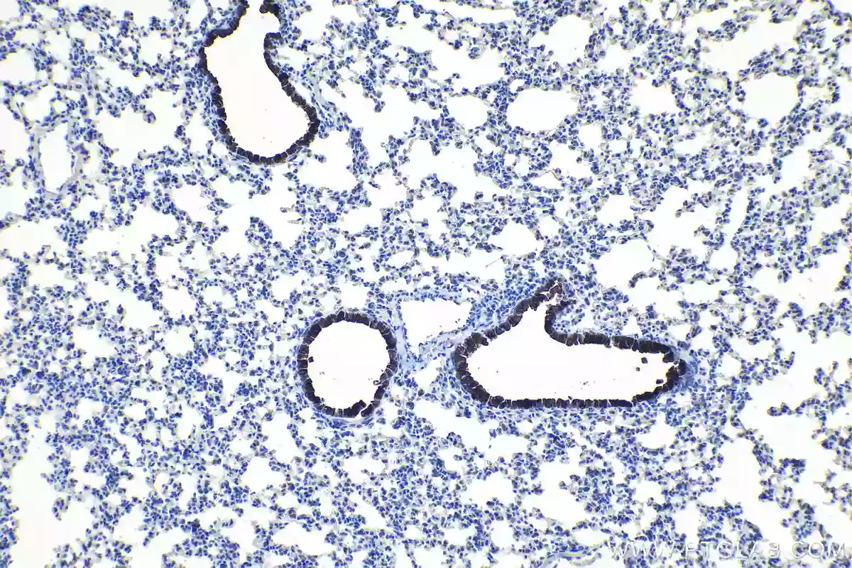 Uteroglobin/CC10 antibody (10490-1-AP) | Proteintech