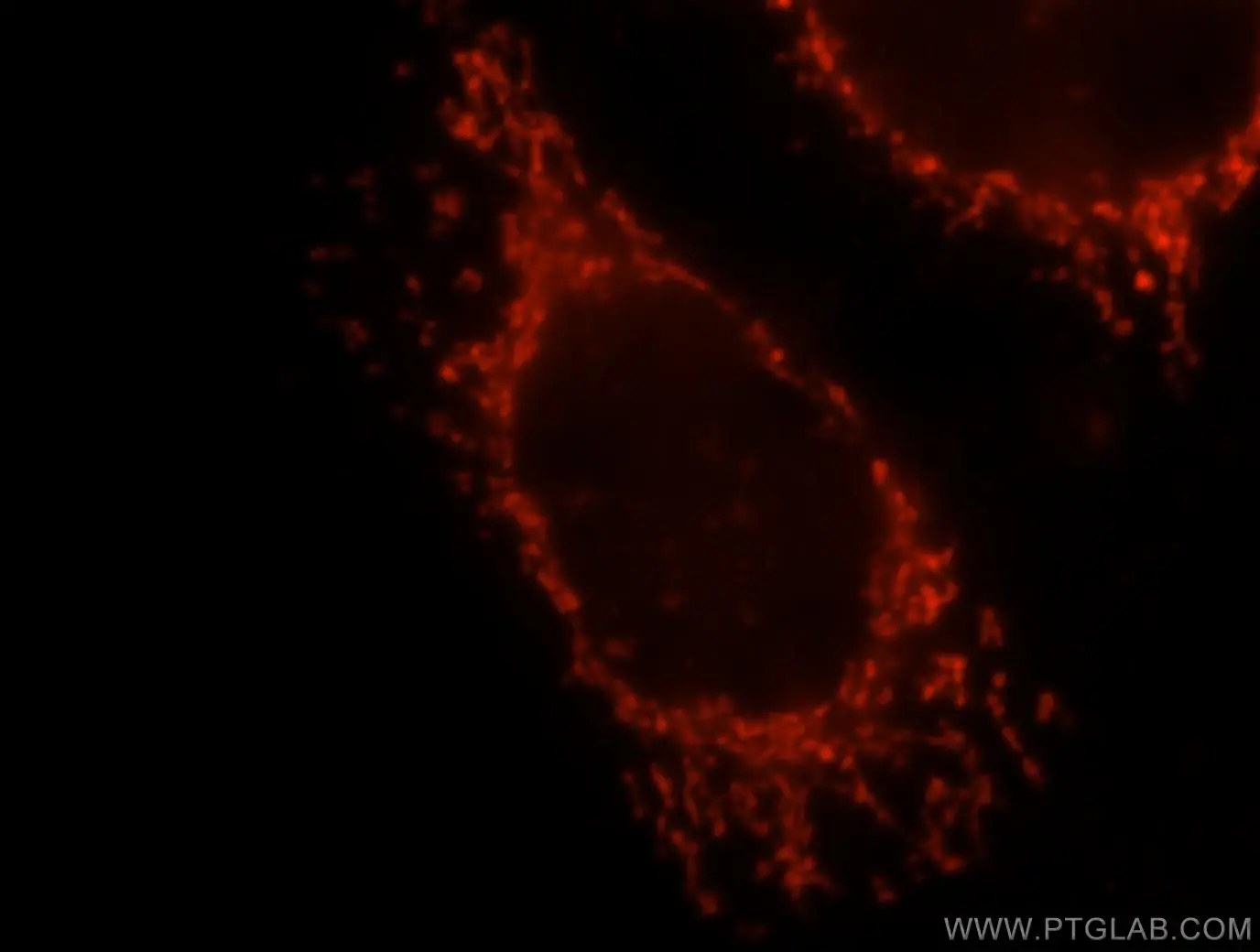Immunofluorescent analysis of MCF-7 cells, using OXCT1 antibody