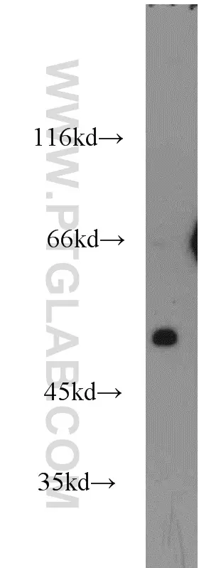 SCTR antibody (14172-1-AP) | Proteintech