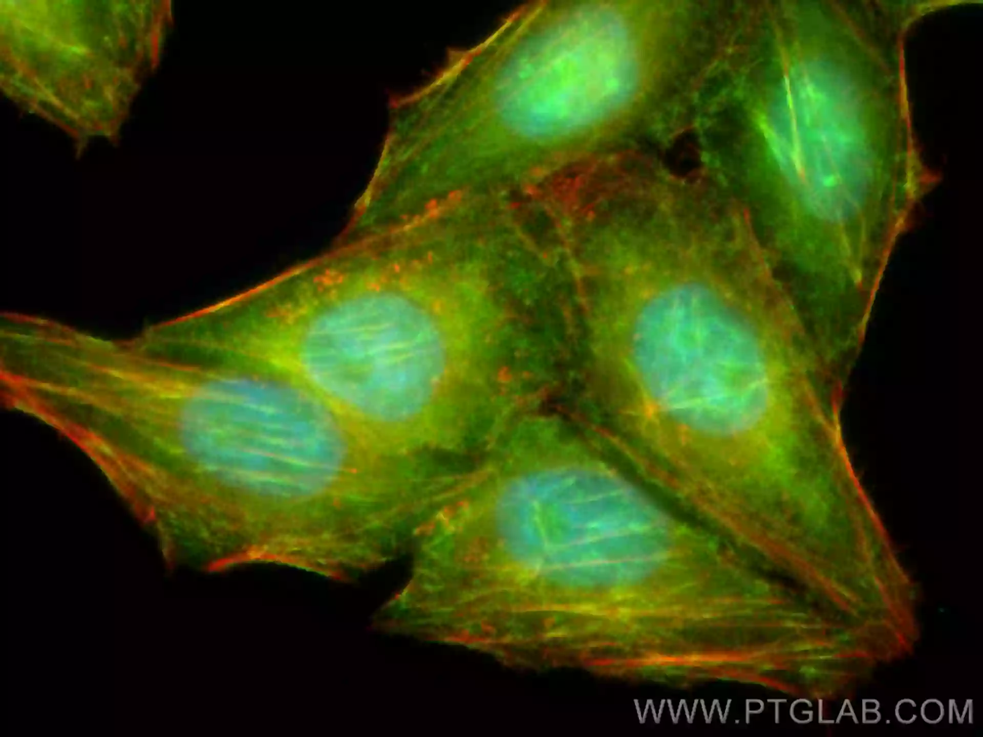 Septin 2 antibody (11397-1-AP) | Proteintech