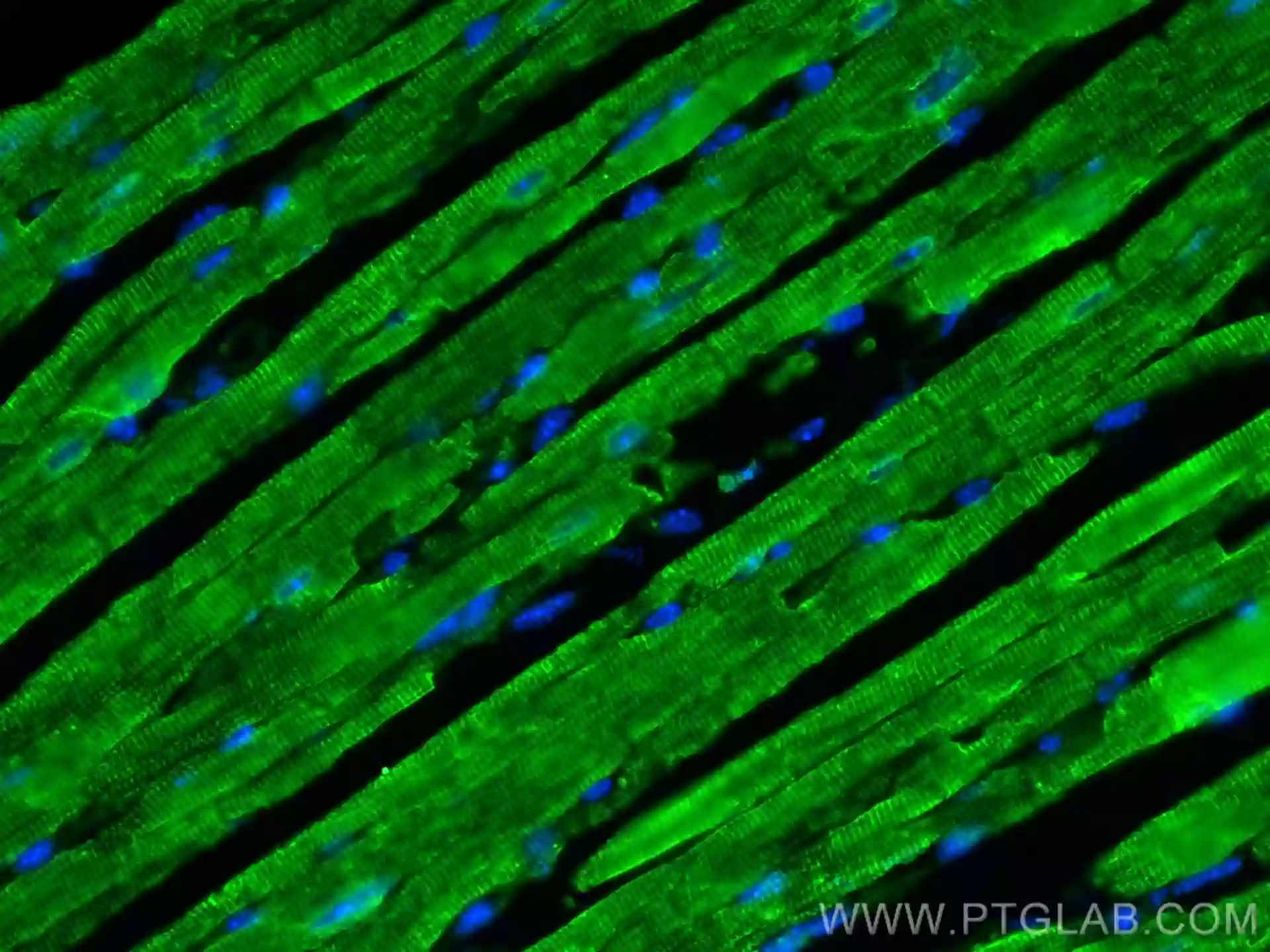 SERCA2,ATP2A2 antibody (27311-1-AP) | Proteintech