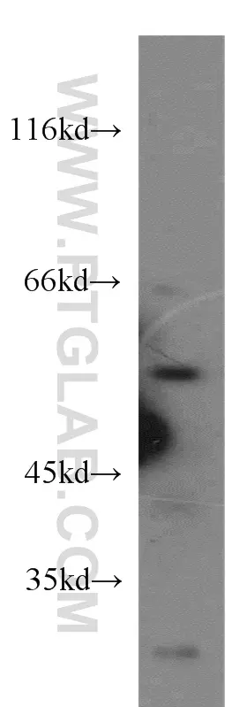 SESN1 antibody (21668-1-AP) | Proteintech