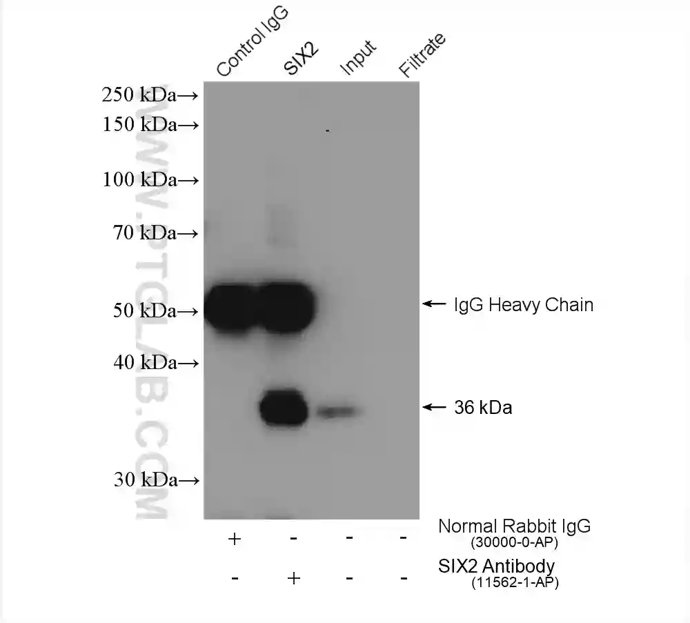 SIX2 antibody (11562-1-AP) | Proteintech