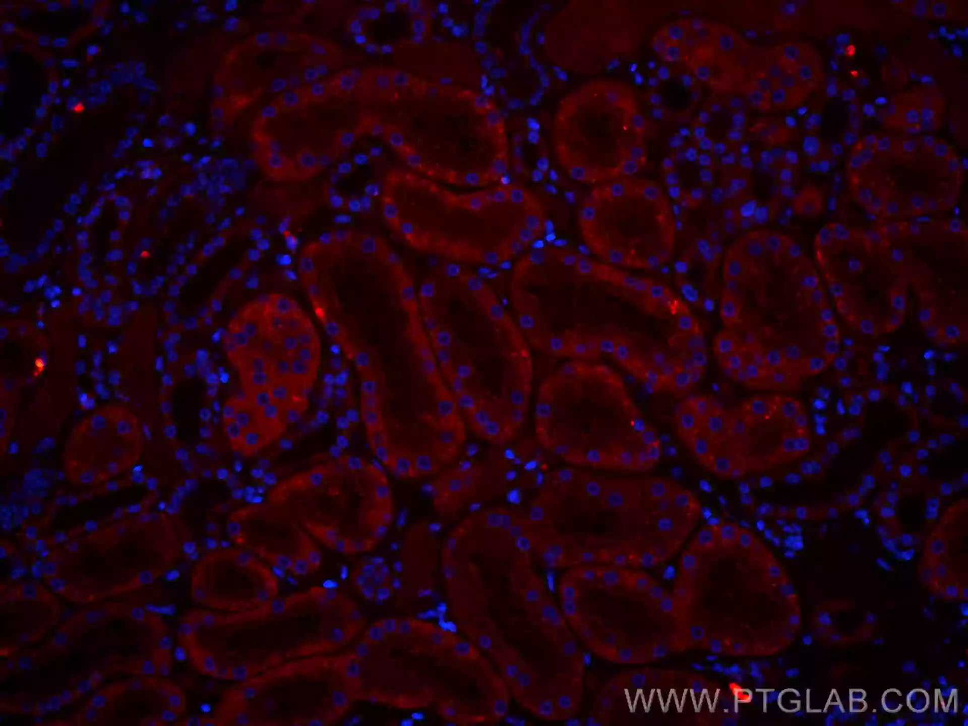 SLC2A9 antibody (CL594-67530) | Proteintech