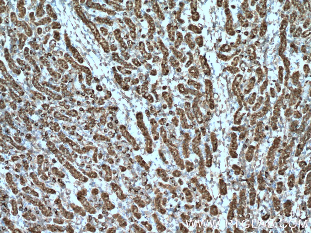 ZIP8 antibody (20459-1-AP) | Proteintech