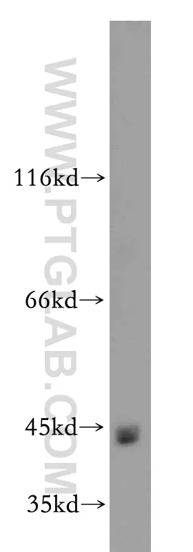 ZIP8 antibody (20459-1-AP) | Proteintech