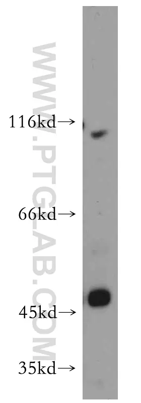 ZIP8 antibody (20459-1-AP) | Proteintech