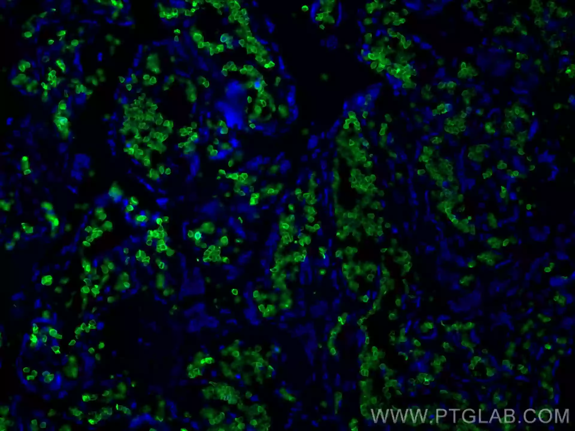 Band 3/ AE1 antibody (28131-1-AP) | Proteintech