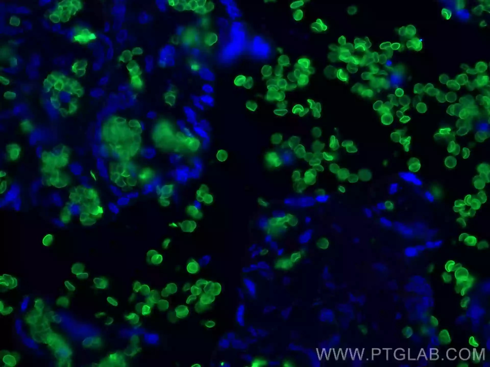 Band 3/ AE1 antibody (28131-1-AP) | Proteintech