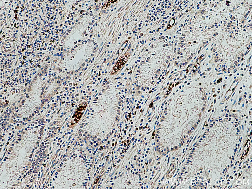 Band 3/ AE1 antibody (28131-1-AP) | Proteintech