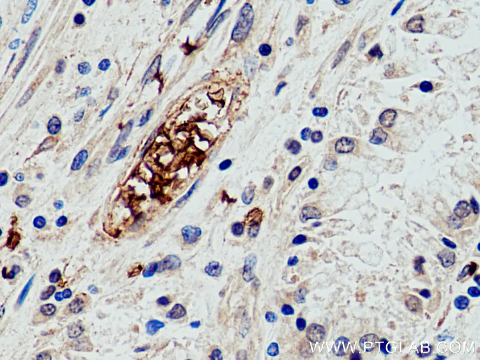 Band 3/ AE1 antibody (28131-1-AP) | Proteintech