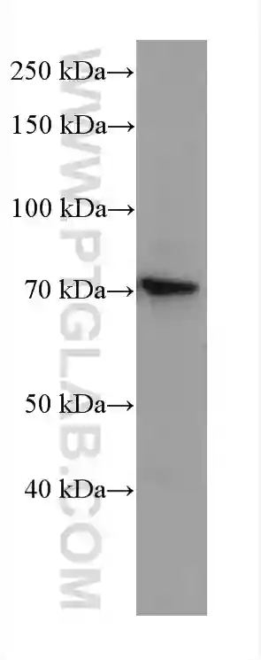 SLC6A12 antibody (67700-1-Ig) | Proteintech