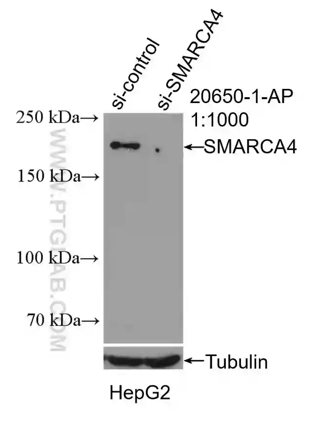 SMARCA4/BRG1 antibody (20650-1-AP) | Proteintech