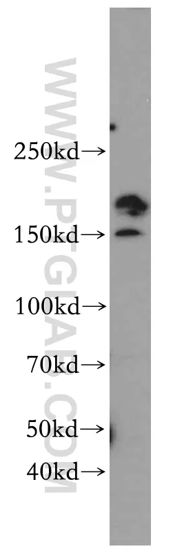 SMARCA4/BRG1 antibody (20650-1-AP) | Proteintech