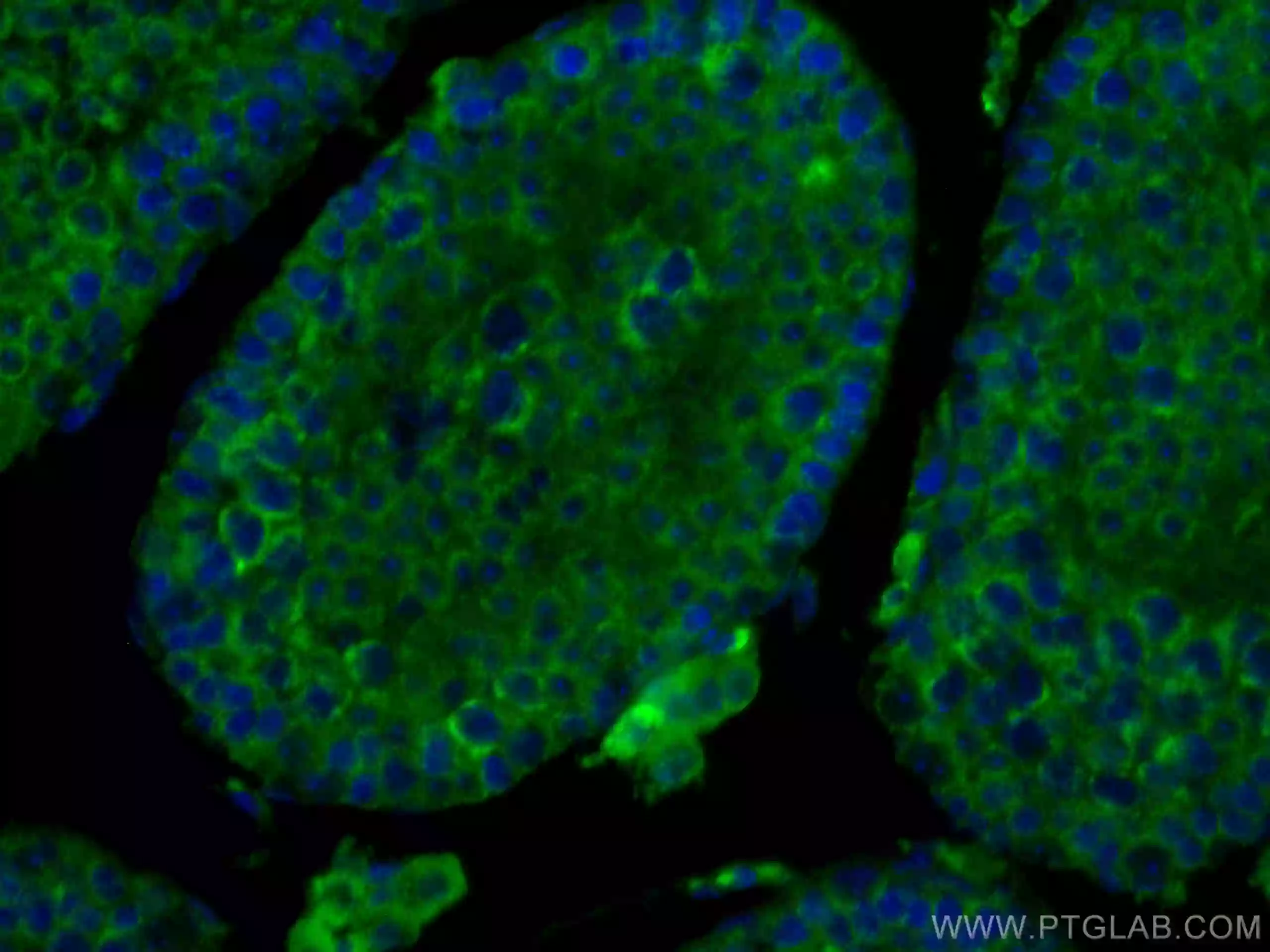 SMCR7L antibody (67808-1-Ig) | Proteintech