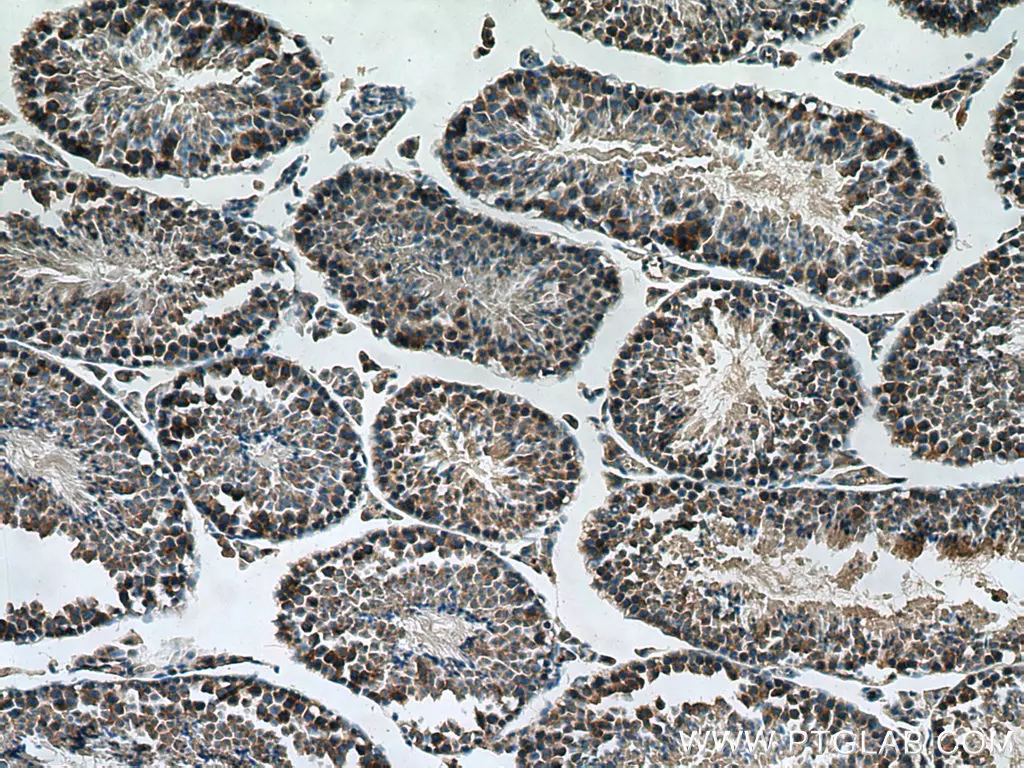 SMCR7L antibody (67808-1-Ig) | Proteintech