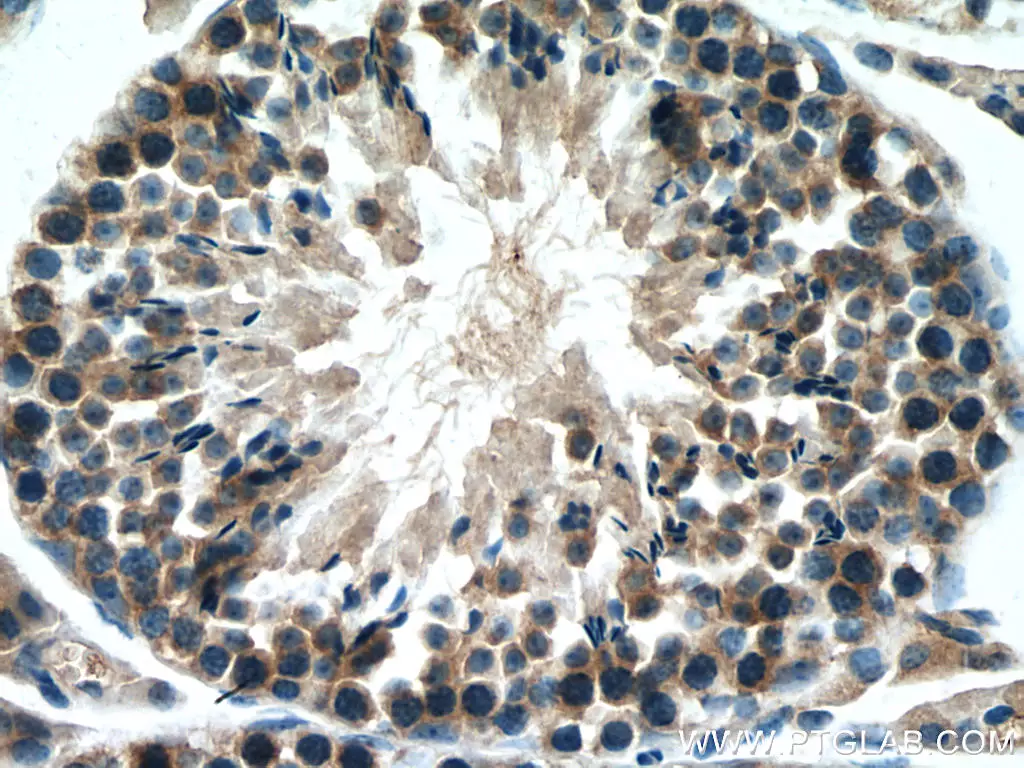 SMCR7L antibody (67808-1-Ig) | Proteintech