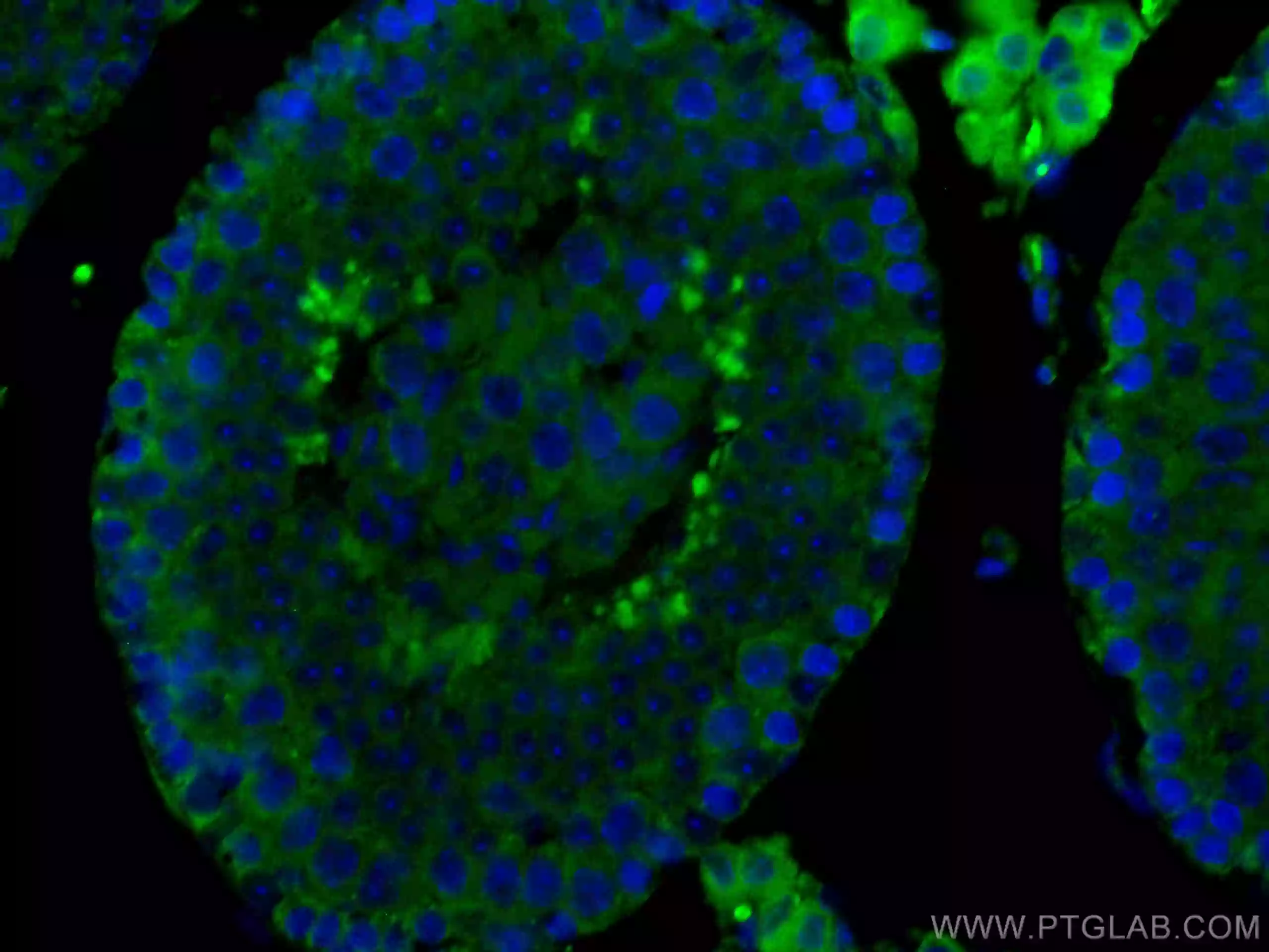Immunofluorescent analysis of fixed mouse testis tissue using SMCR7L antibody