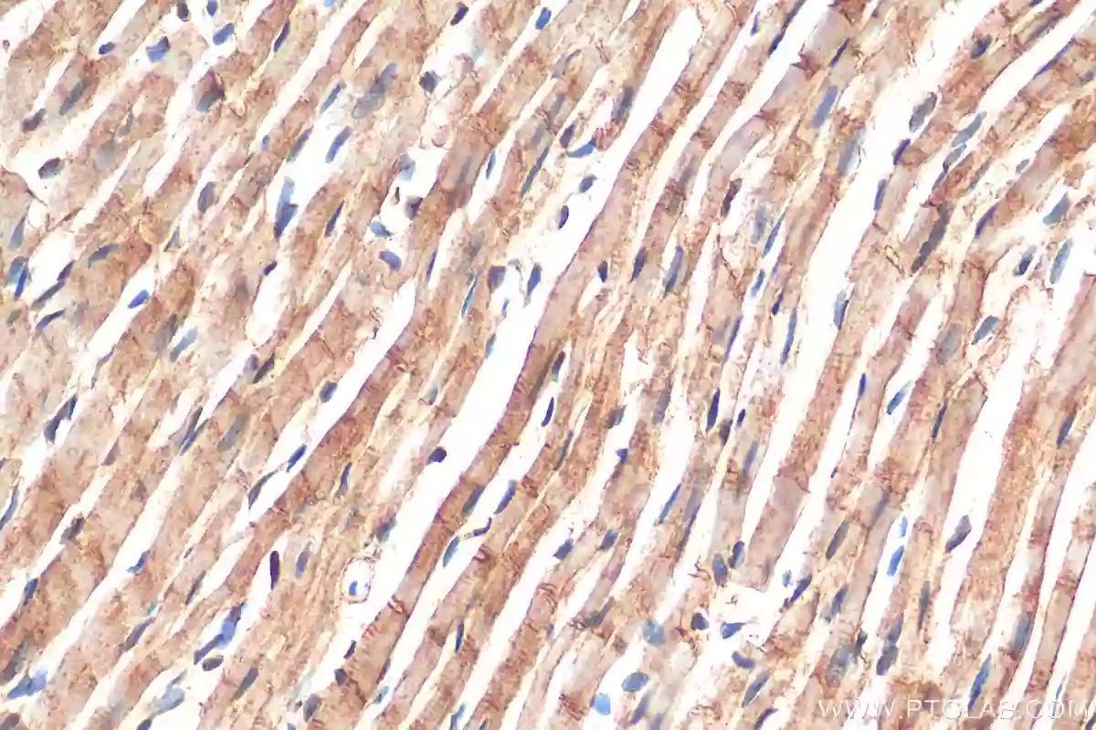 SMYD2 antibody (21290-1-AP) | Proteintech