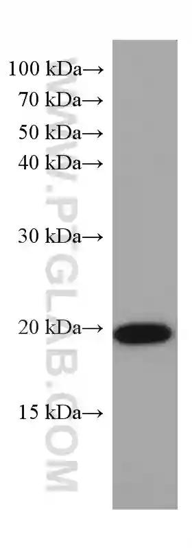 SOD1 antibody (67480-1-Ig) | Proteintech