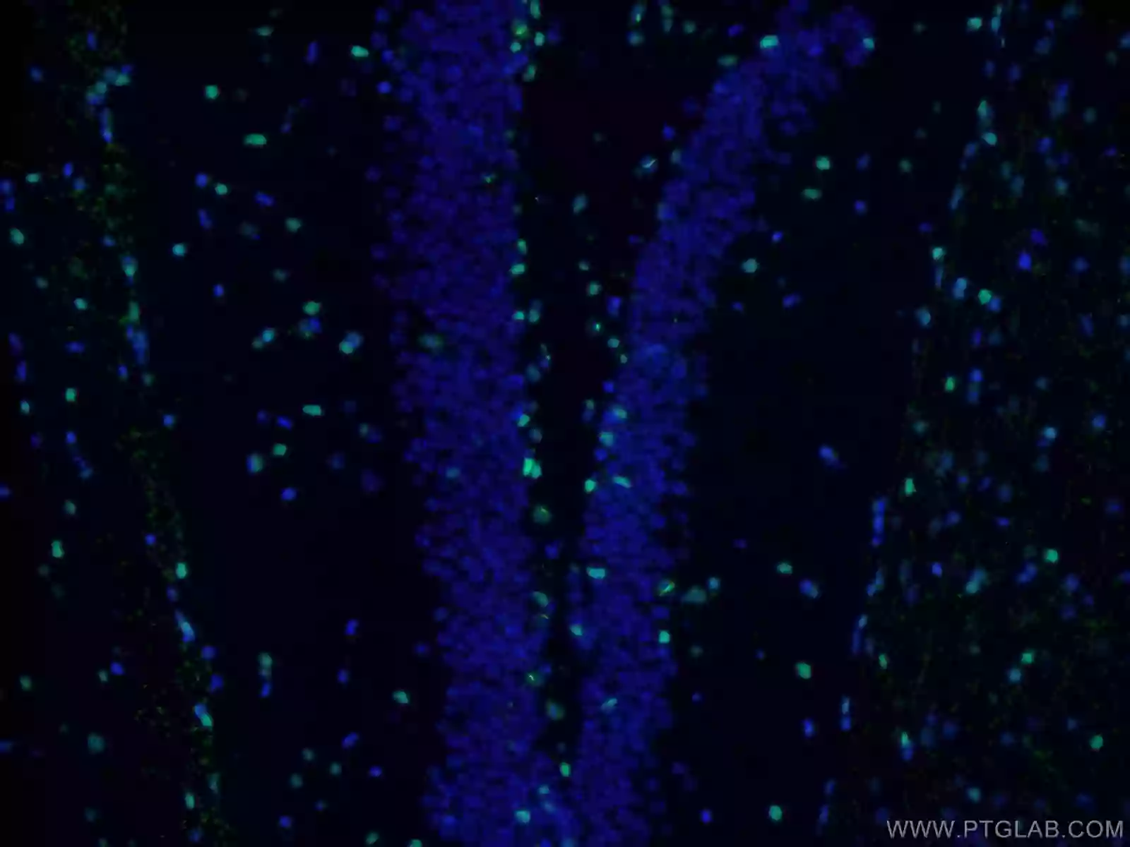 immunofluorescence (IF) staining of iPS cells using Proteintech SOX2 antibody (11064-1-AP)
