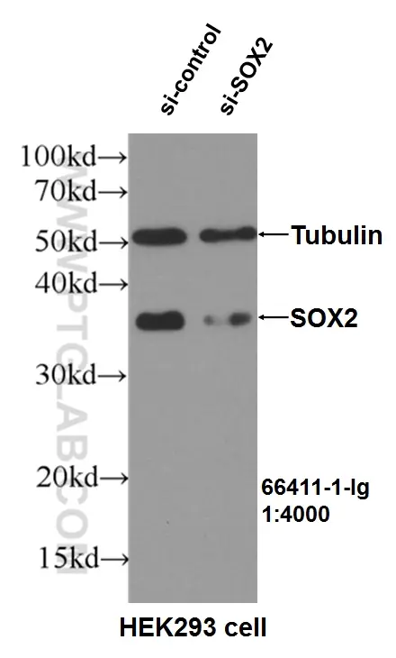 SOX2 antibody (66411-1-Ig) | Proteintech