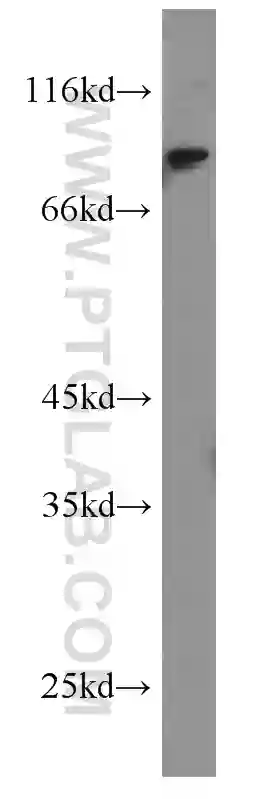 SOX6 antibody (14010-1-AP) | Proteintech