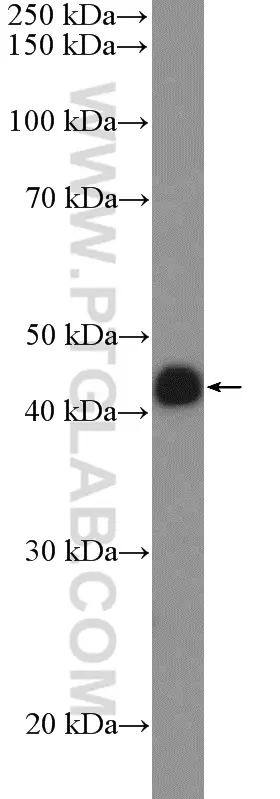 SPDEF antibody (11467-1-AP) | Proteintech