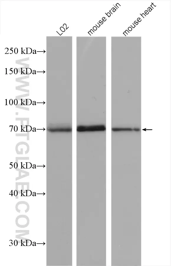 SPHK2 antibody (17096-1-AP) | Proteintech