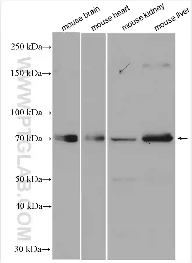 SPHK2 antibody (17096-1-AP) | Proteintech