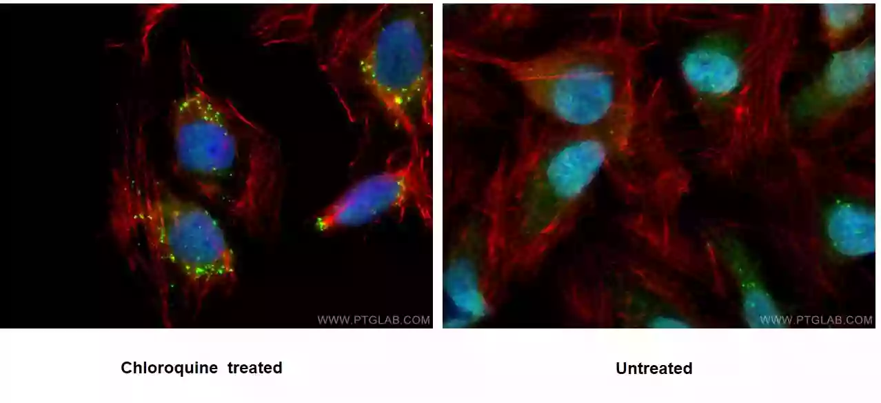 P62,SQSTM1 antibody (18420-1-AP) | Proteintech