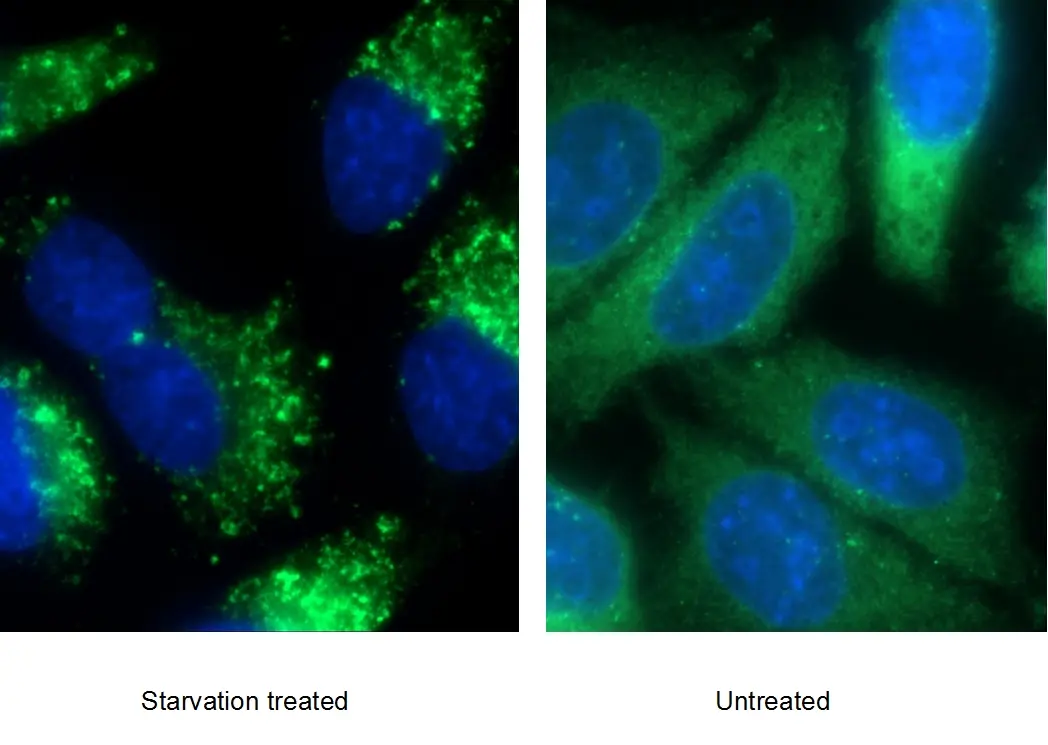 P62,SQSTM1 antibody (18420-1-AP) | Proteintech