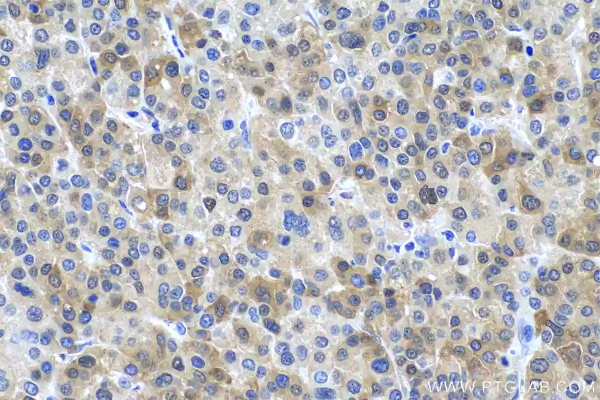 P62,SQSTM1 antibody (18420-1-AP) | Proteintech