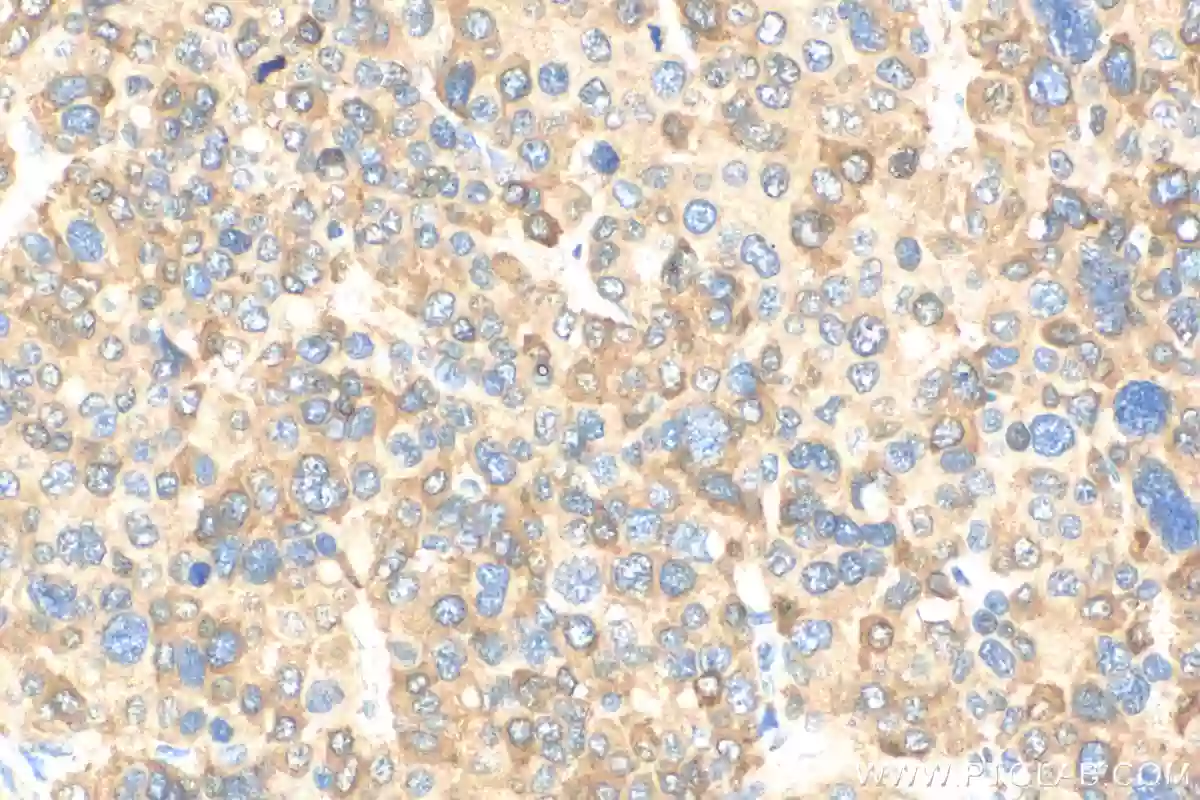 P62,SQSTM1 antibody (18420-1-AP) | Proteintech