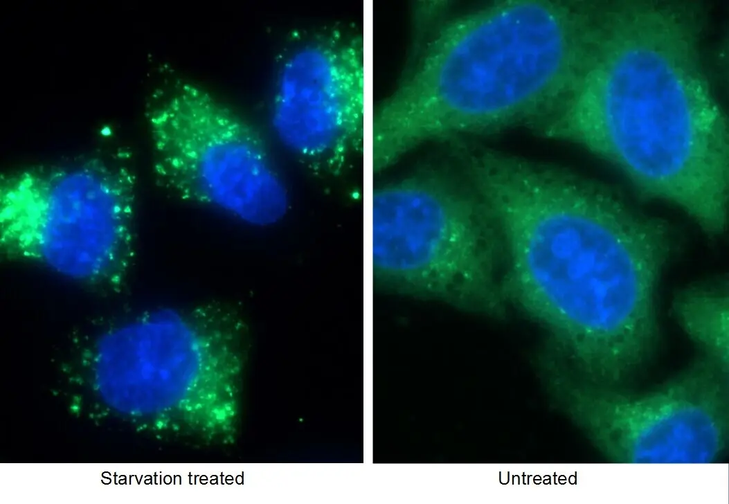 P62/SQSTM1 antibody (55274-1-AP) | Proteintech