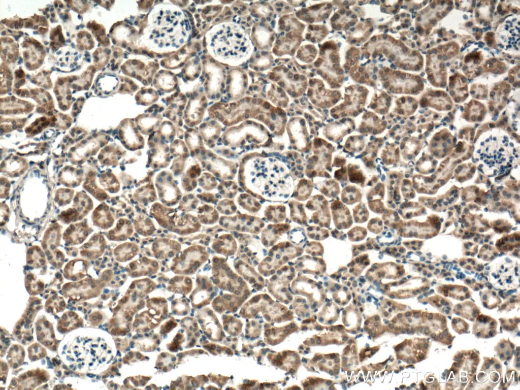 P62/SQSTM1 antibody (55274-1-AP) | Proteintech